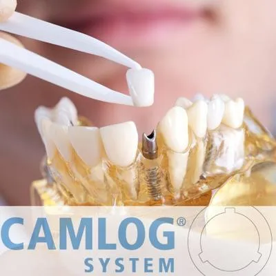 Camlog implant