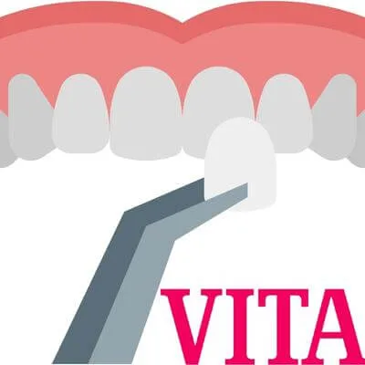 Dental veneers vita